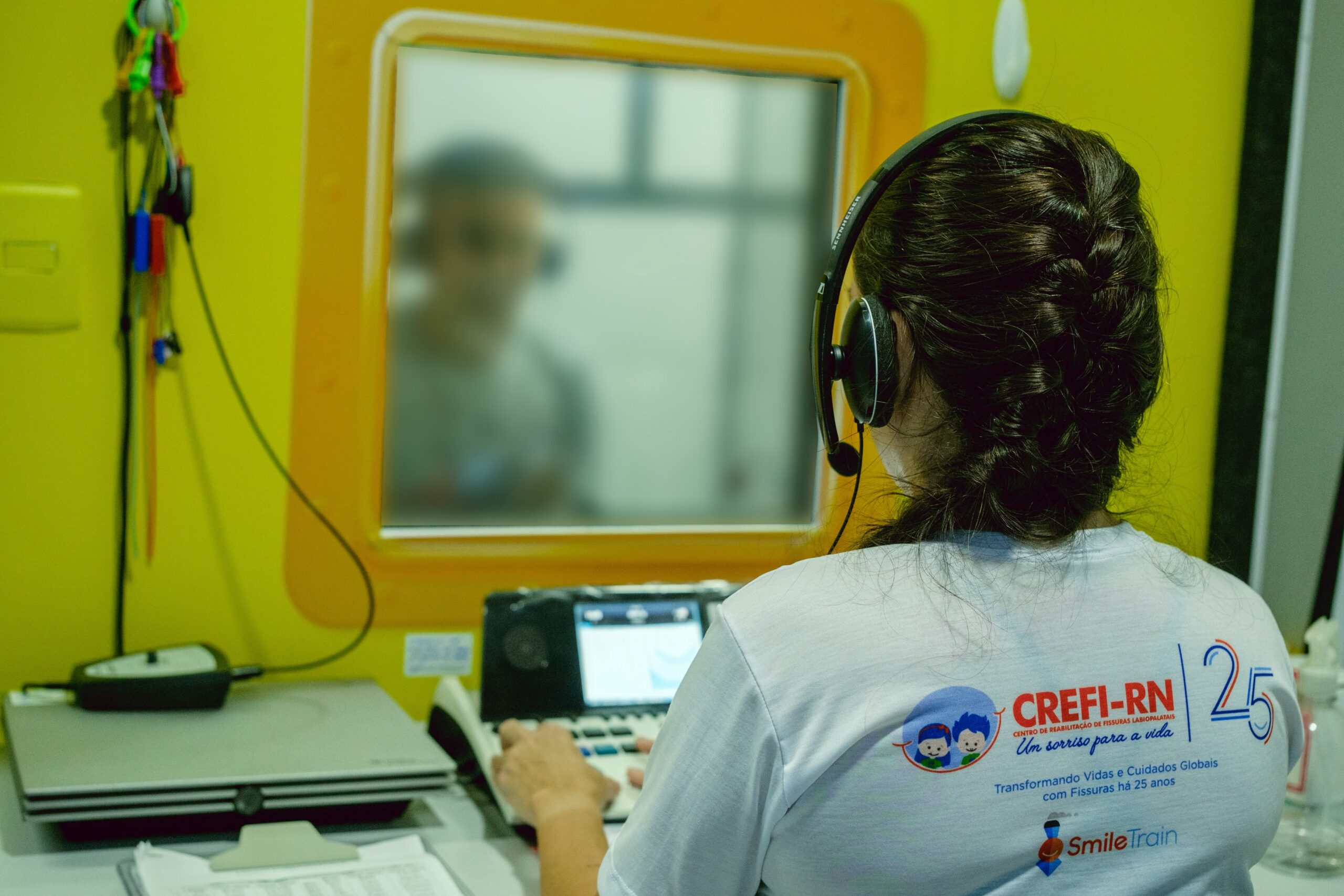Hospital Infantil Varela Santiago promove ação para ampliar tratamento de fissuras labiopalatais no RN