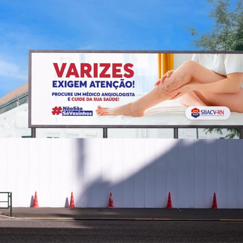 SBACV-RN lança campanha educativa: “Não são só vasinhos! Varizes exigem atenção!”