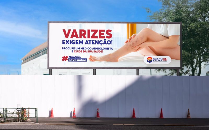 SBACV-RN lança campanha educativa: “Não são só vasinhos! Varizes exigem atenção!”