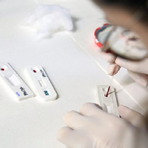 JULHO AMARELO: Hepatites A, B e C são os tipos mais comuns no RN