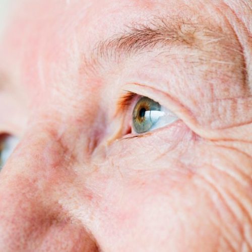 Pesquisa sobre relação do Alzheimer com pâncreas e fígado conta com pesquisadores potiguares