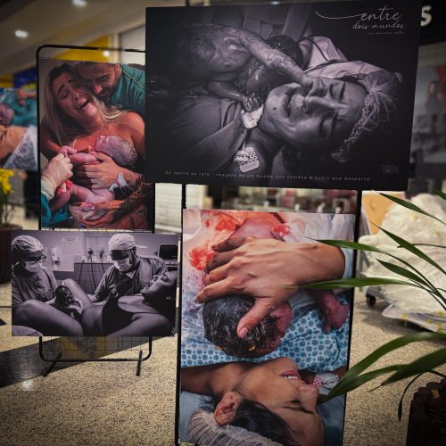 Exposição “Entre Dois Mundos” traz a emoção do 1° encontro entre mãe e bebê em Natal