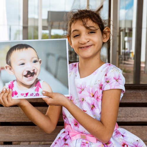 Operação Sorriso: exposição fotográfica no Natal Shopping marca retorno da ação voluntária
