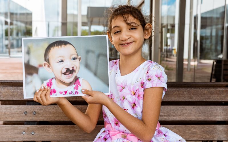 Operação Sorriso: exposição fotográfica no Natal Shopping marca retorno da ação voluntária